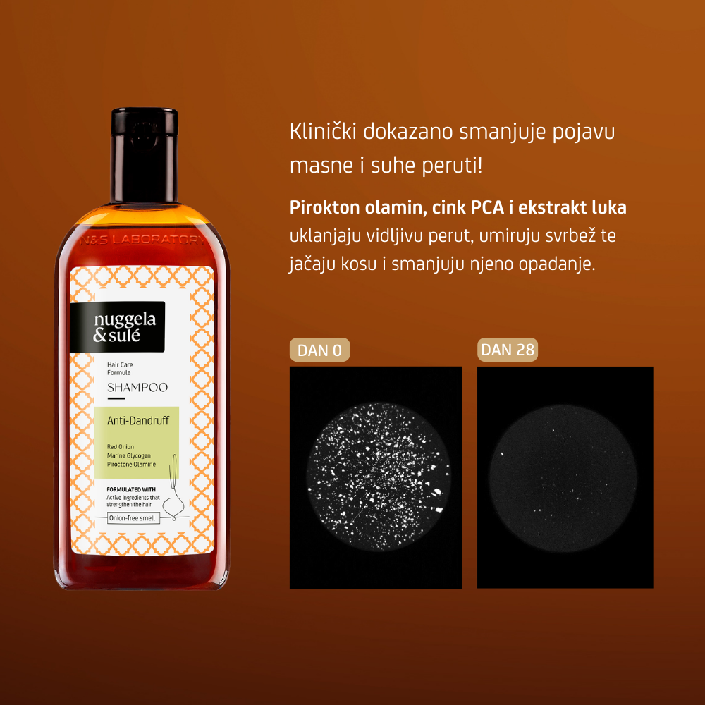 Nuggela &amp; Sulé | Šampon proti prhljaju
